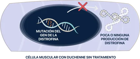 Célula muscular de Duchenne sin tratamiento